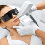 laser hair removal for the face tampa