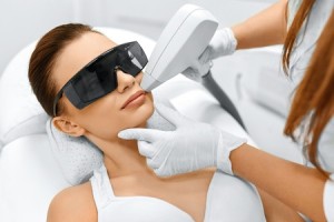 laser hair removal for the face tampa